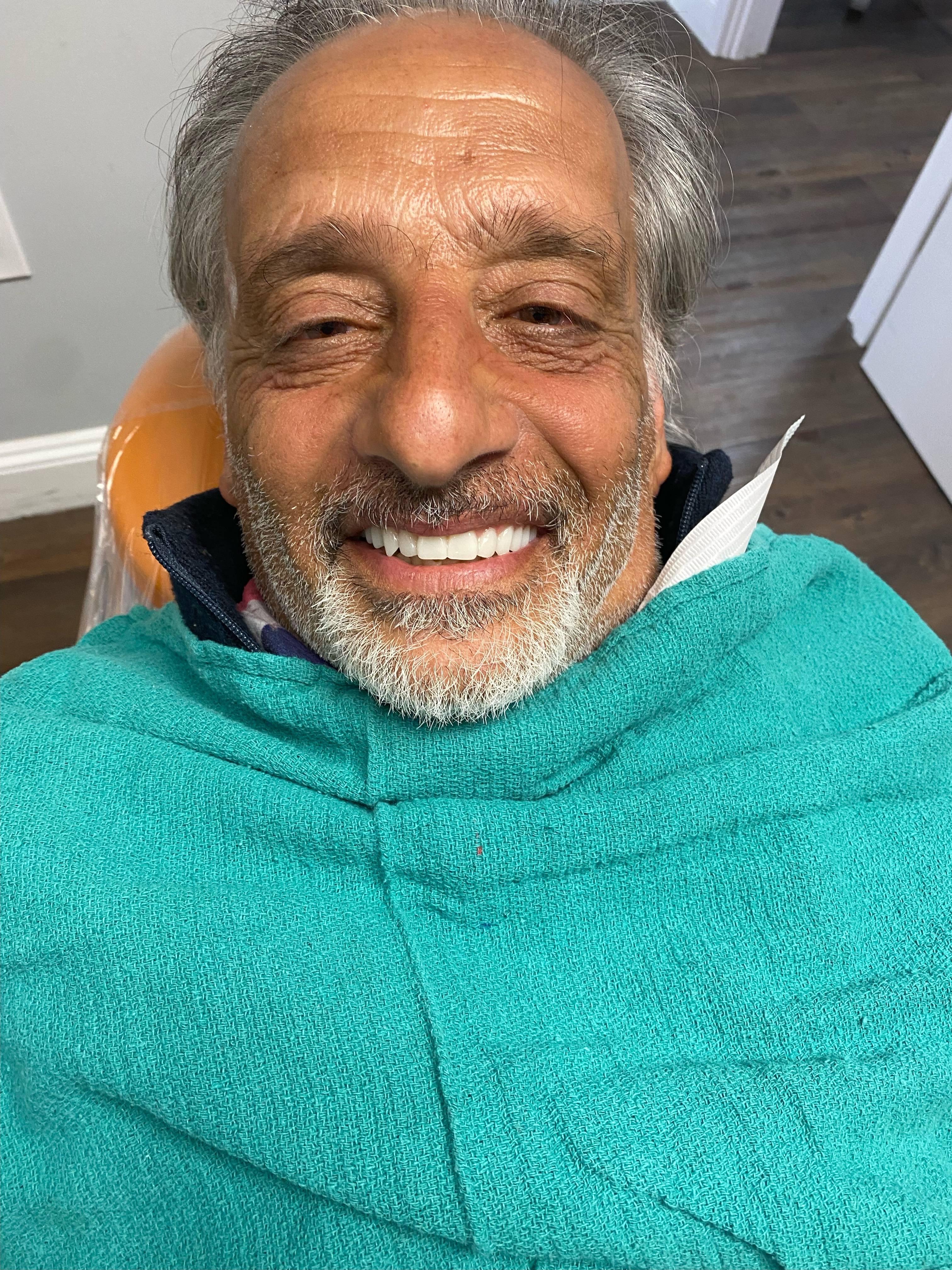 Cosmetic dentistry result — James